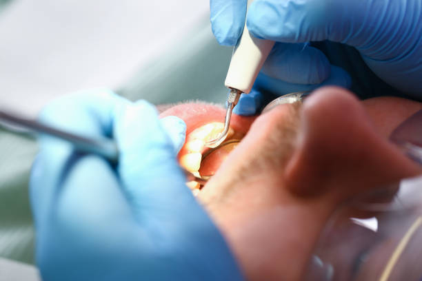Best Urgent Dental Care for Toothache in Aledo, IL