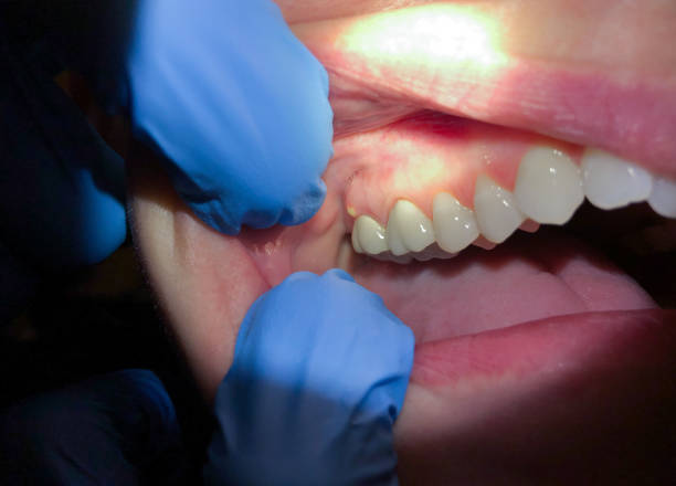 Best Pediatric Emergency Dentist in Aledo, IL